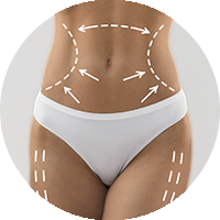 Imagem Cirurgia Corporal
