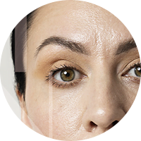 marta-nagai-imagem-interna-blefaroplastia-elipse